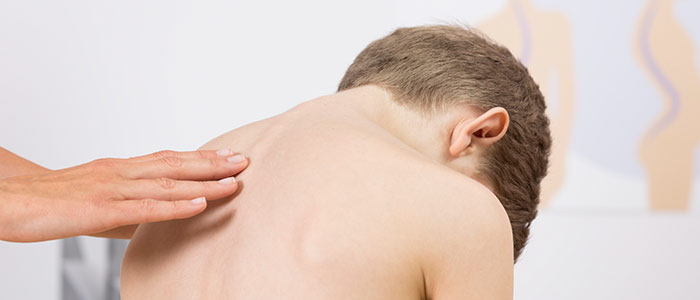 Chiropractic Care in Cincinnati For Scoliosis Relief